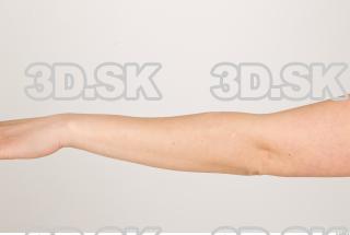 Forearm texture of Pat 0001